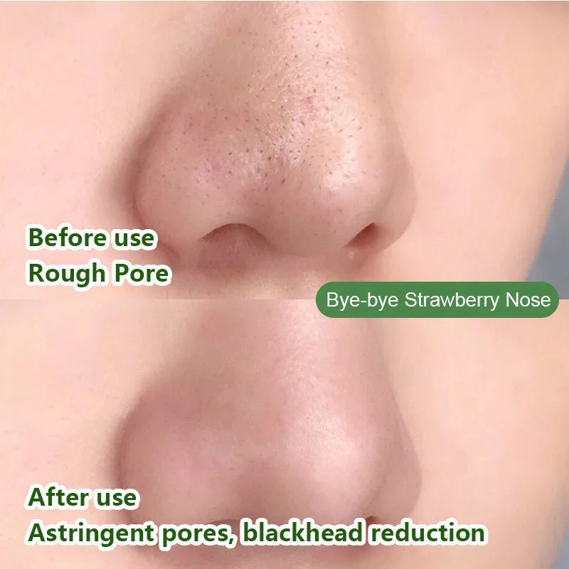 Fast Remove Blackhead Green Tea Solid Mask Clean Stick Mask Facial Dispel Acne Blemish Shrink Pores